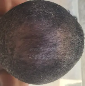 Borga Hair Growth