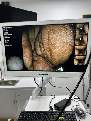Endoscopys