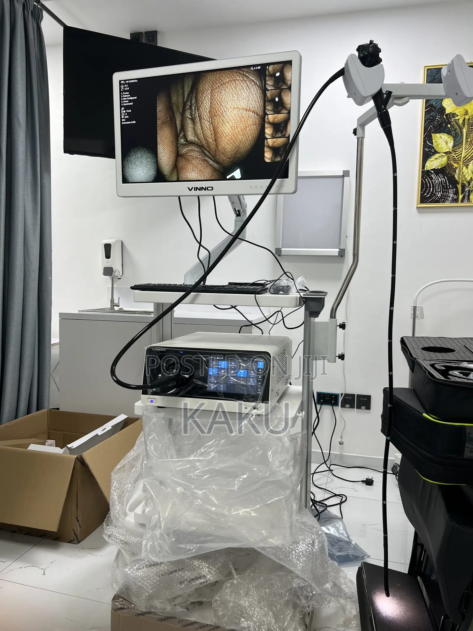 Endoscopys