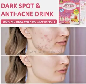 Anti Aging, Winkles, Dark Spots, Anti Ace Drink 2000mg,Skin Whitening