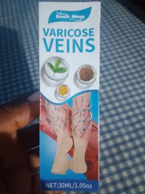 Varicose Vein Spray