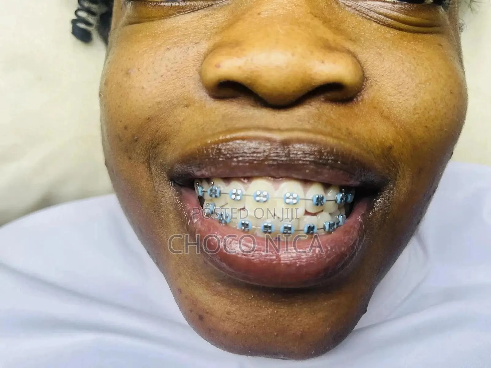 Fashion Brace