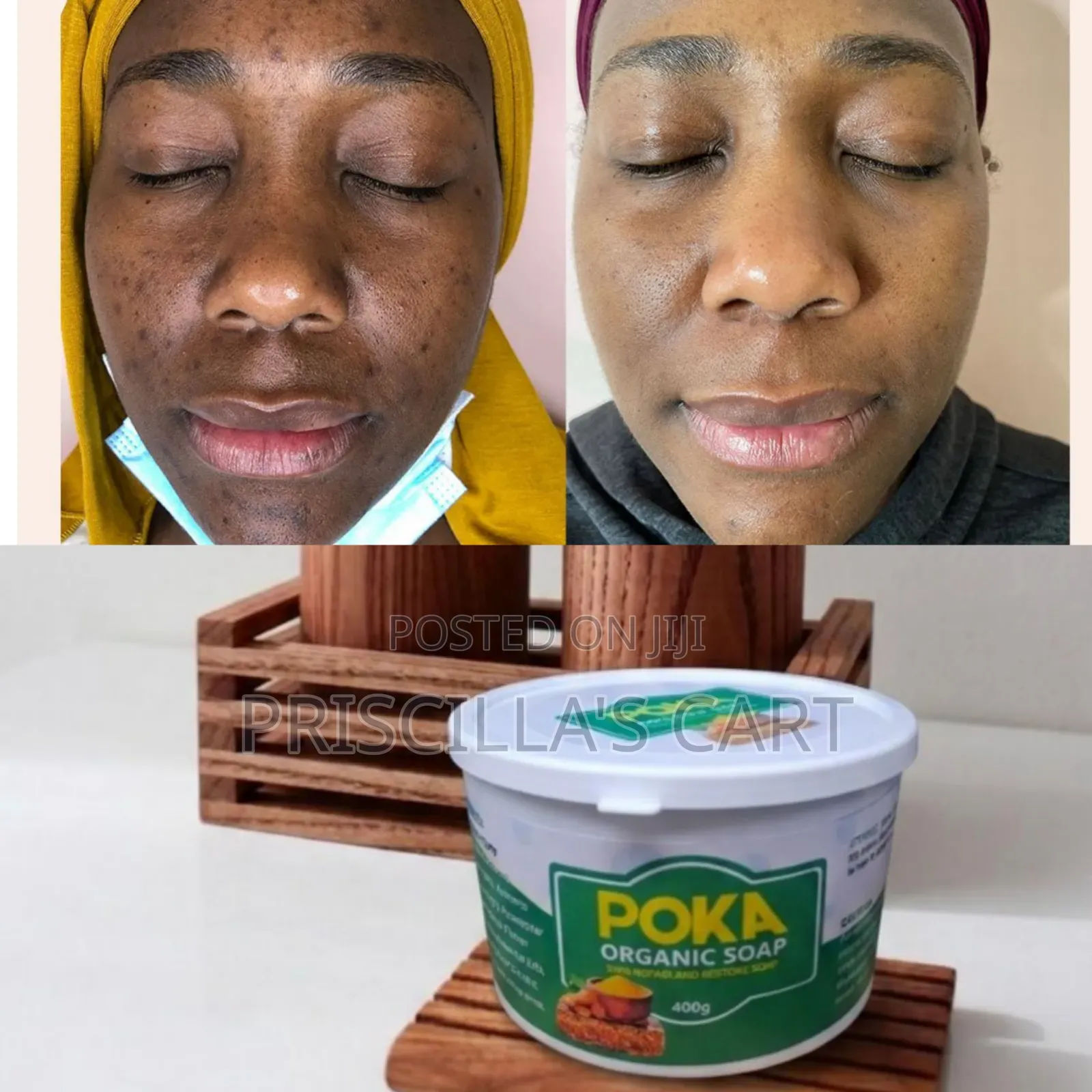 Poka Skin Repair and Restore Soap (400g Sundamage, Glow Soap)
