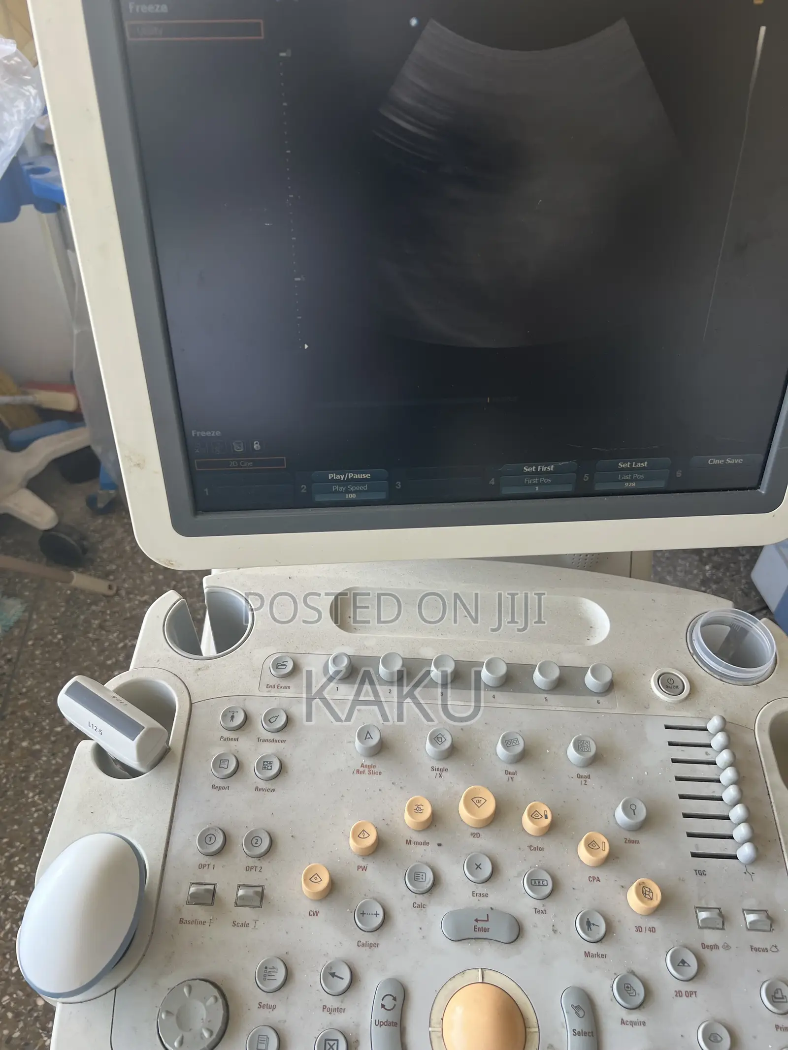 Philips HD9 Ultrasound