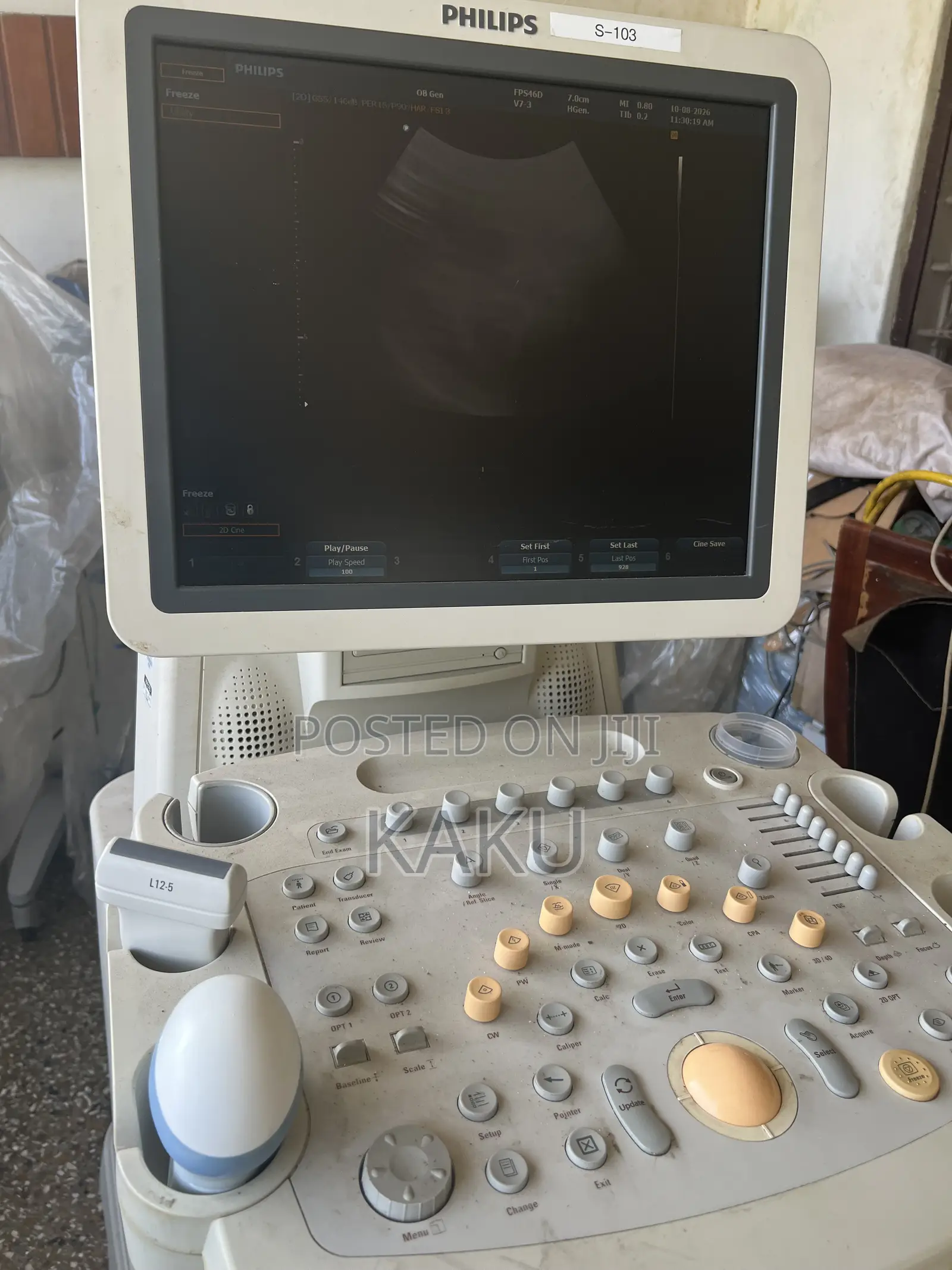 Philips HD9 Ultrasound