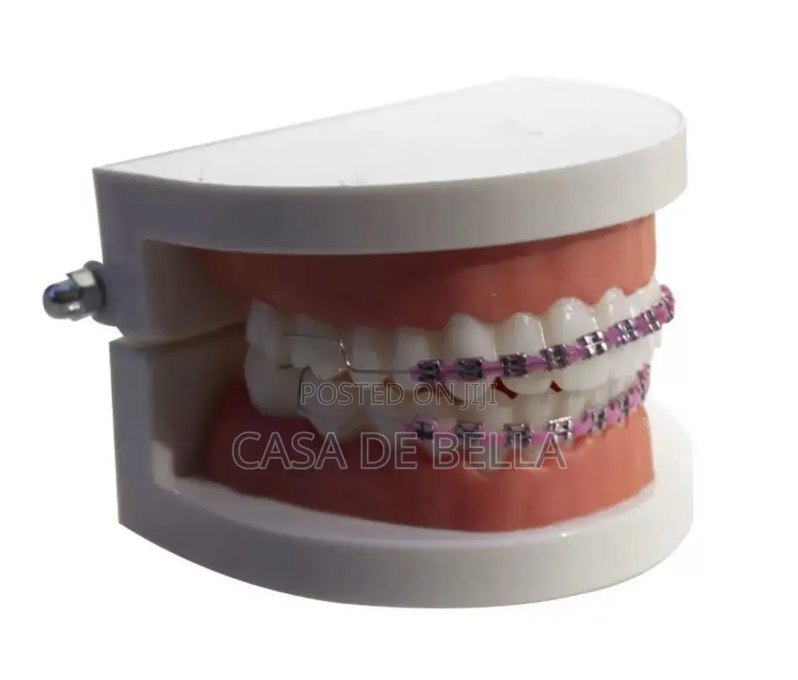 Removable Fashion Braces