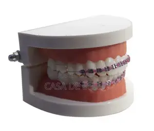 Removable Fashion Braces
