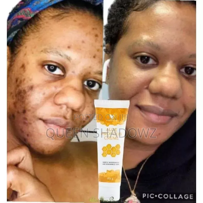 Forever Skin Care