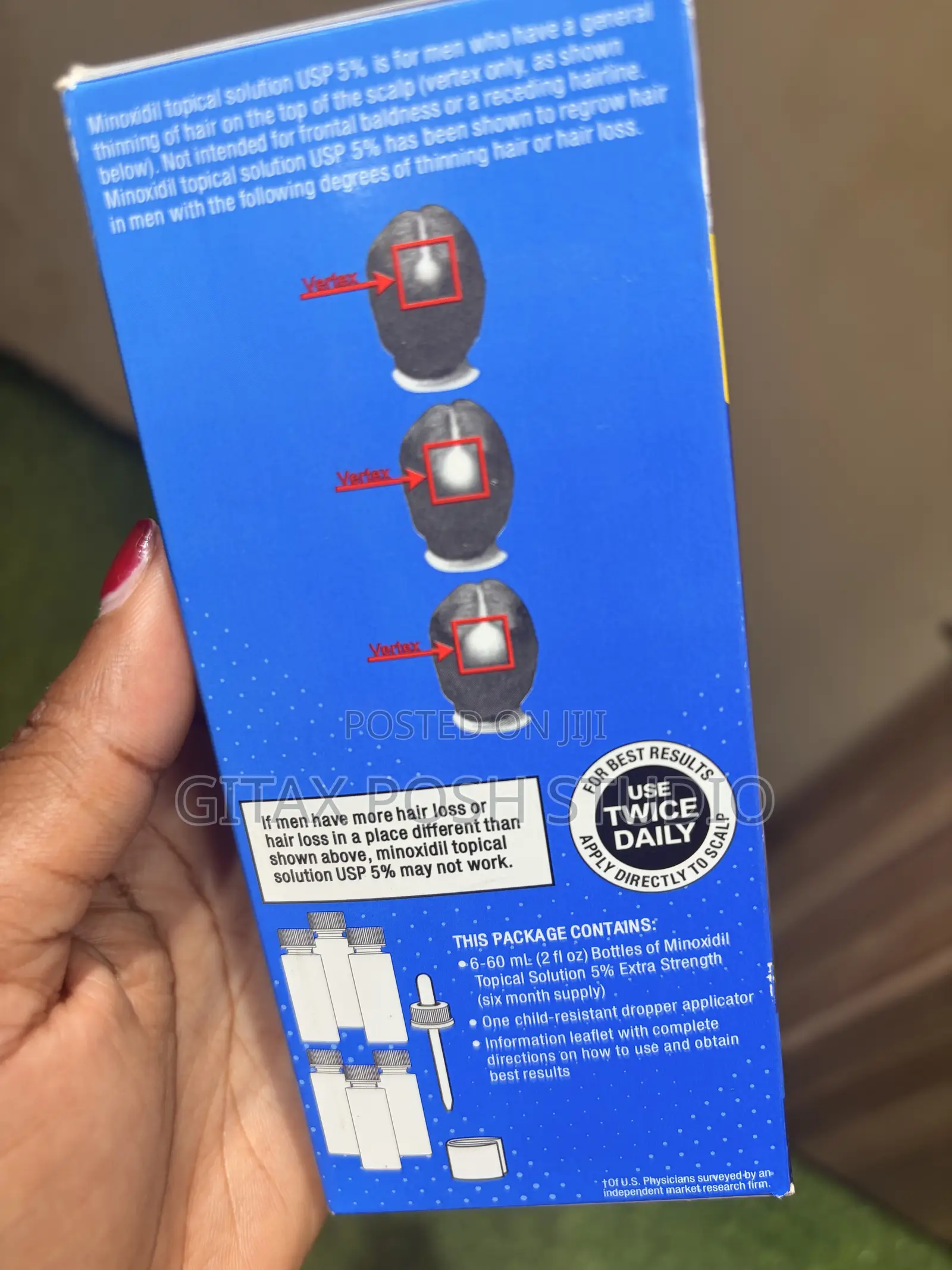 Kirkland Minoxidil