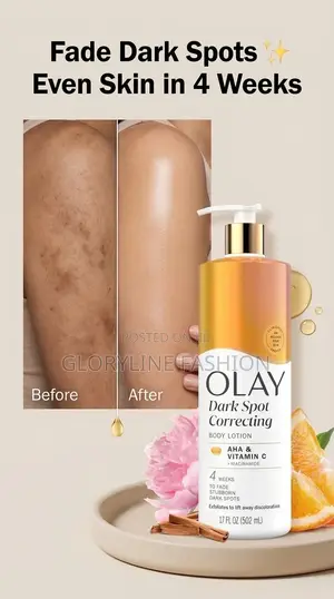 Olay Dark Spot Correcting Body Lotion and Shower Gel