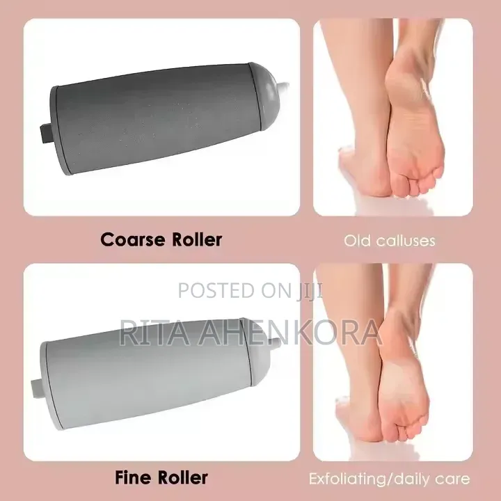 Rechargeable Callus Remover
