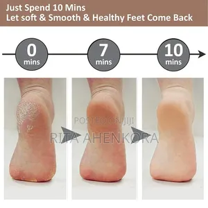Rechargeable Callus Remover