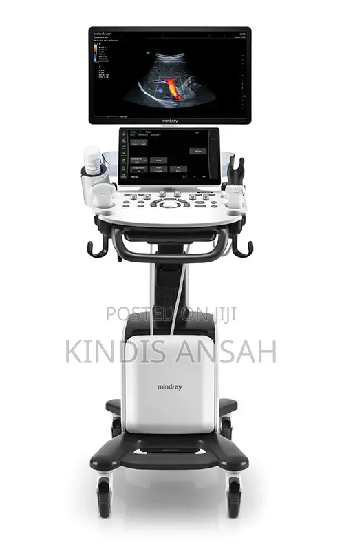 Ultrasound