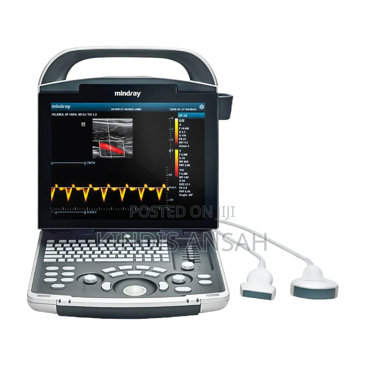 Dp 10 Ultrasound