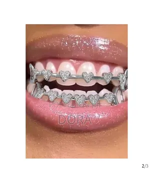 Grillz for Men and Women