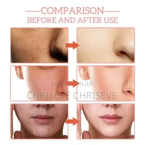 5in1 Face Serum