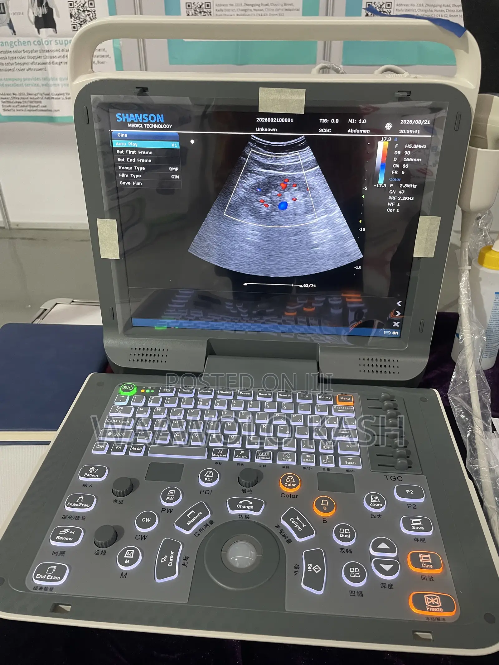 Color Dopper Ultrasound System