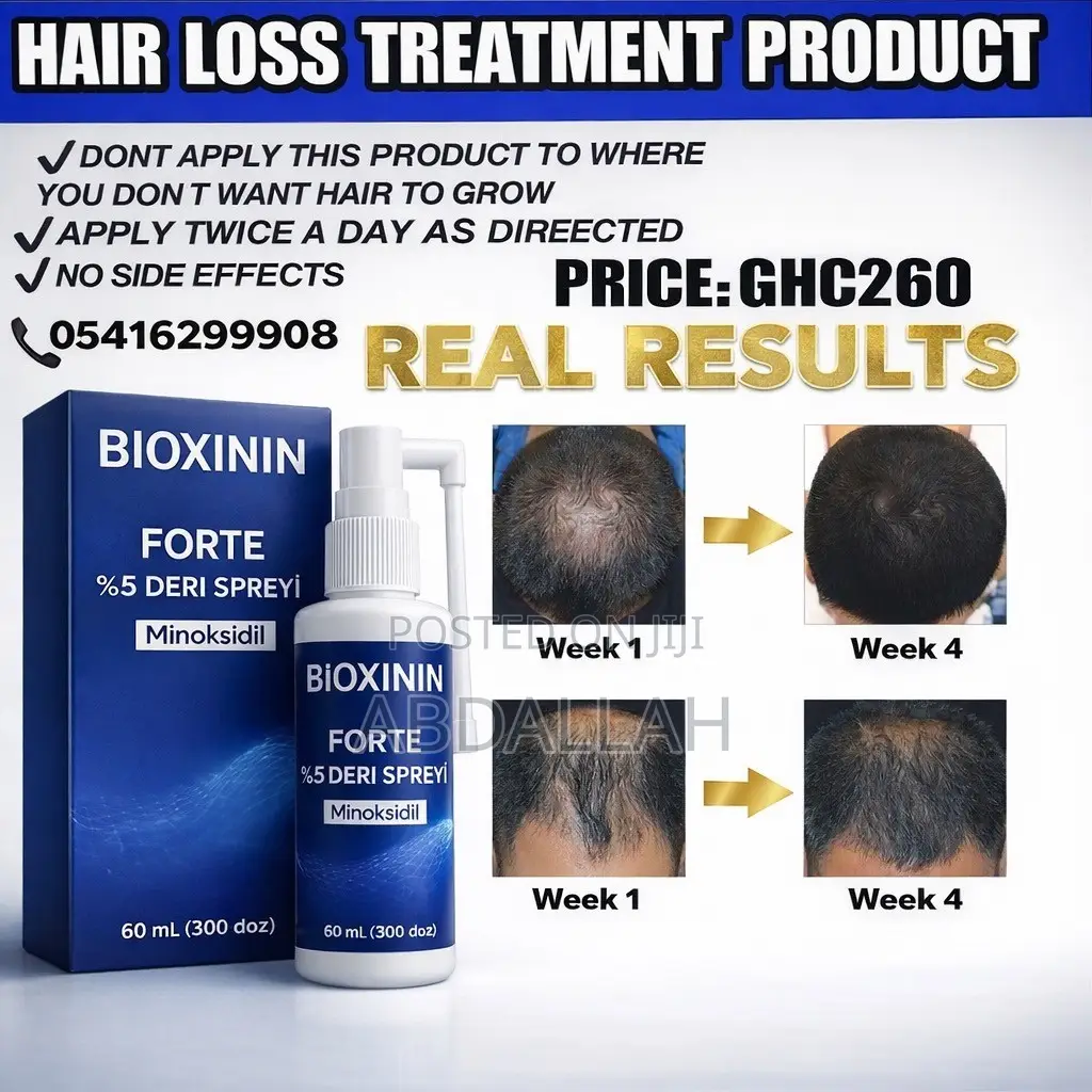 BIOXININ MINOXIDIL the Best Hair Product for Any Type of Hair Loss
