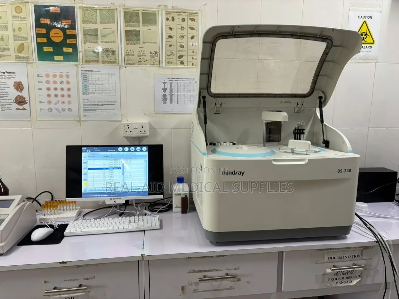Chemistry Analyzer Fully and Semi Automated
