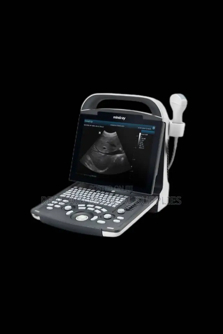 Ultrasound Machine Dp 10