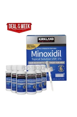 Minoxidil Topical Solution