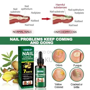 Nail Fungus Treatment