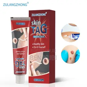 Skin Tag and Keloid Removing Cream