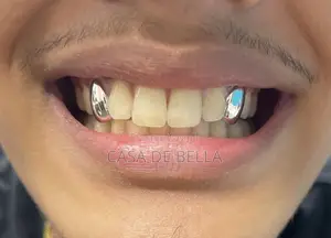 Single Grillz