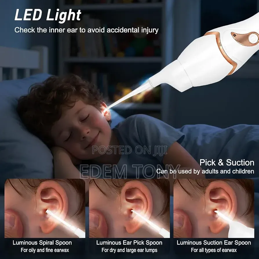 C-Ears Electric Light-Emitting Ear Spoon,(Ear Wax Remover)