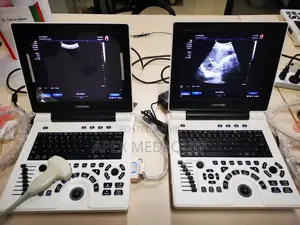 Brandnew SonoTec Portable Ultrasound Scan Machine + 1 Convex Probe