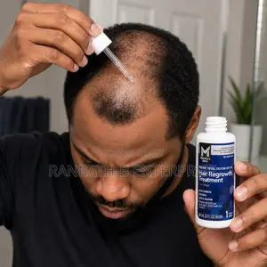Start Your Hair Journey With Member’s Mark 5% Minoxidil Hair Regrowth