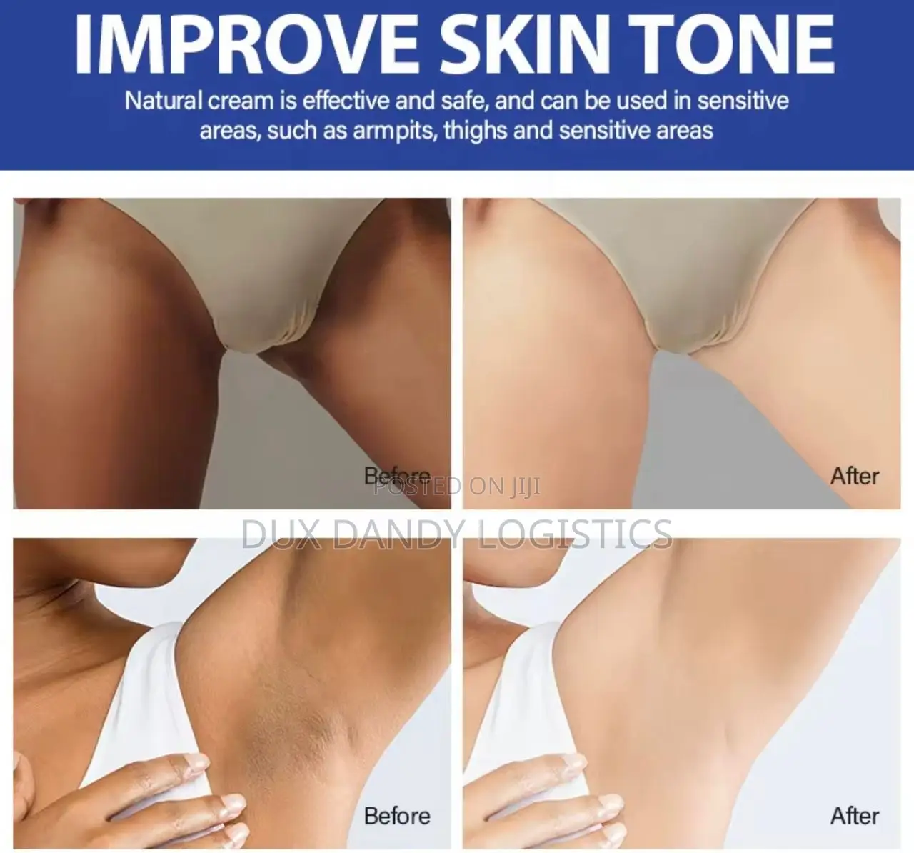 Intense Whitening Cream