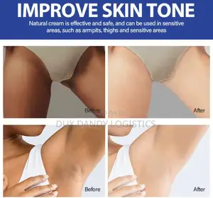 Intense Whitening Cream