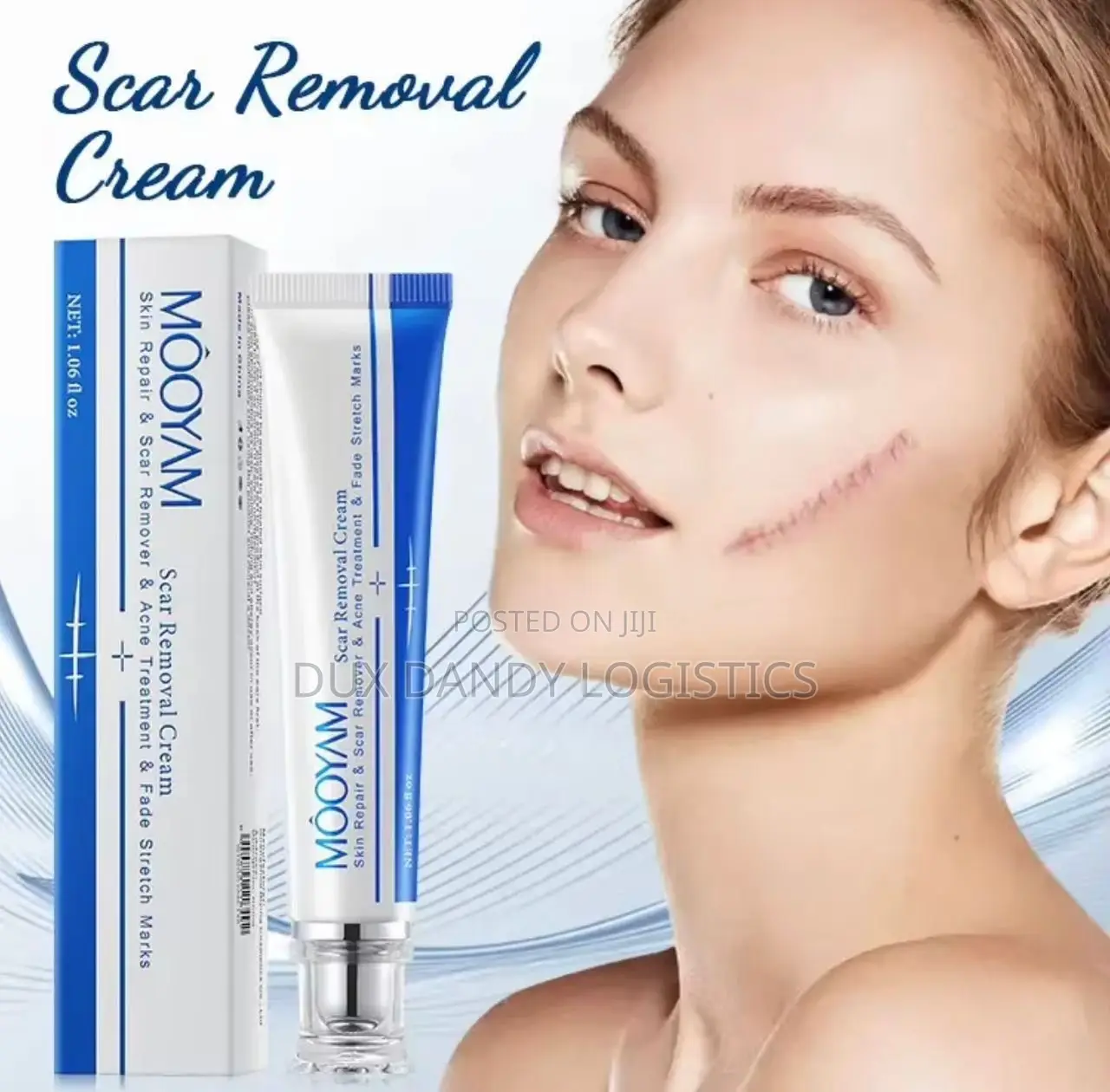 Scar, Stretch Mark, Acne Removal Cream