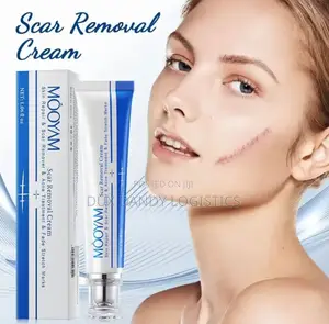 Scar, Stretch Mark, Acne Removal Cream