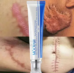 Scar, Stretch Mark, Acne Removal Cream