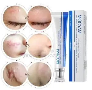 Scar, Stretch Mark, Acne Removal Cream