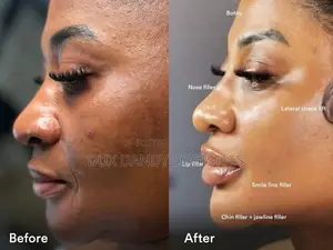 Dark Spot Corrector