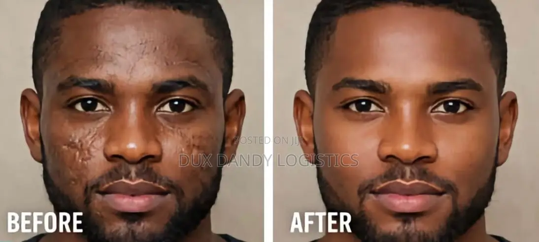 Advanced Scar Gel