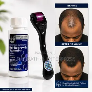 Member’s Mark Minoxidil 5% + Derma Roller Combo | Fuller- Hair Routine
