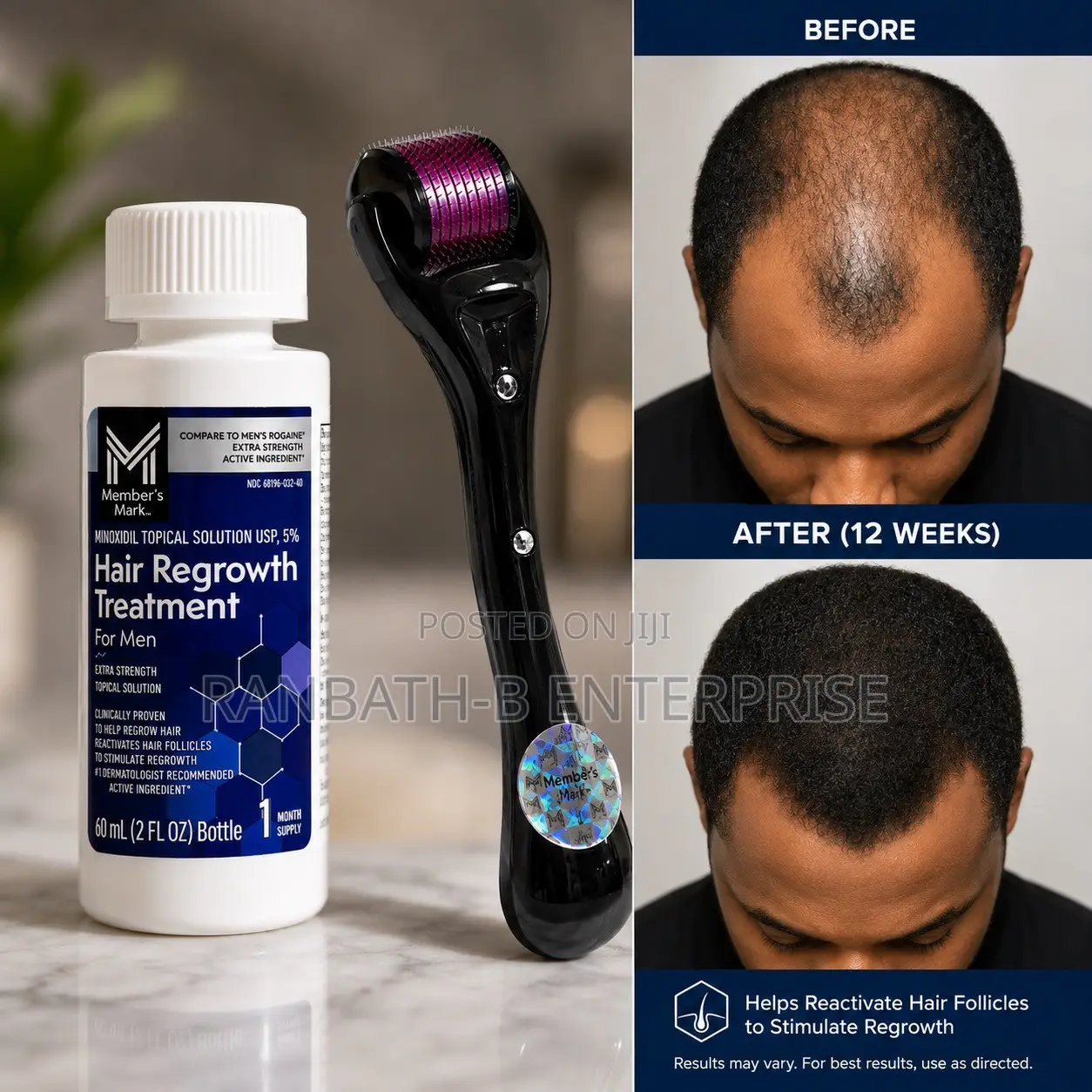Member’s Mark Minoxidil 5% Hair Regrowth Treatment + Derma Roller
