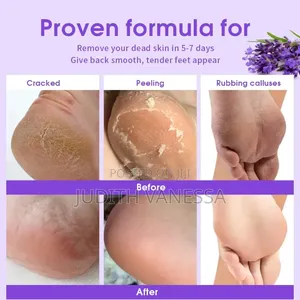 Foot Peel,Exfoliating Foot Mask