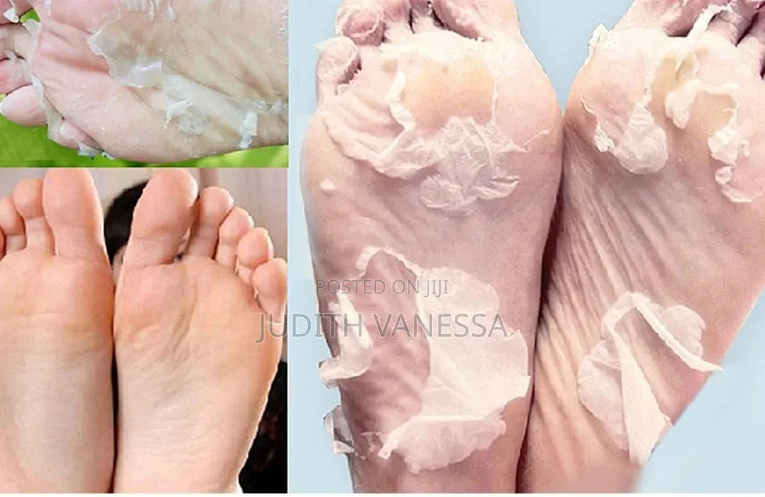 Foot Peel,Exfoliating Foot Mask