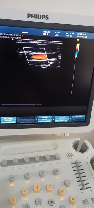 Philips HD 9 Ultrasound
