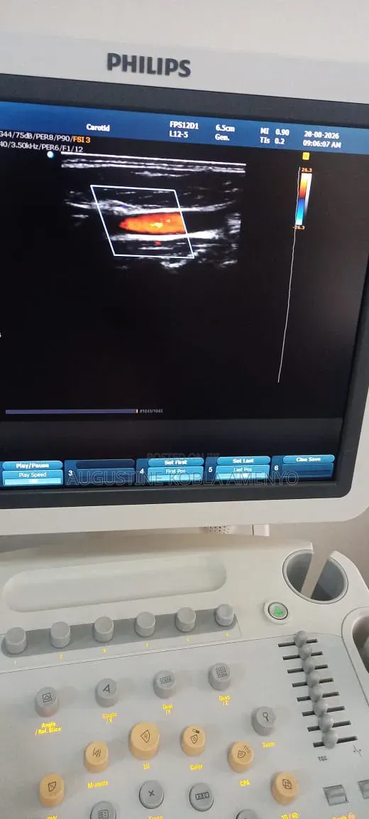 Philips HD 9 Ultrasound