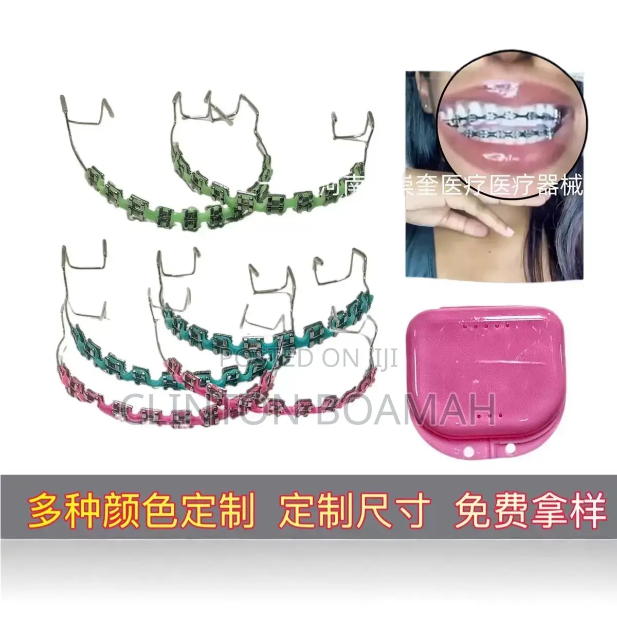 Teeth Braces