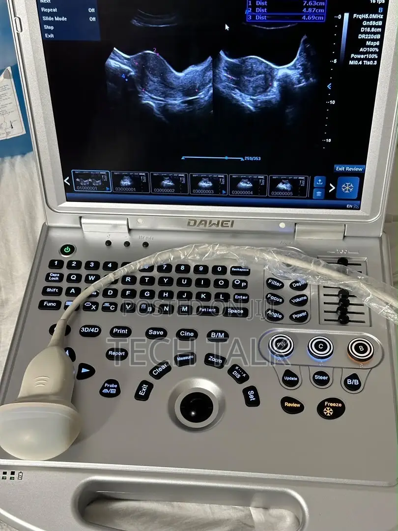 Ultrasound Machine