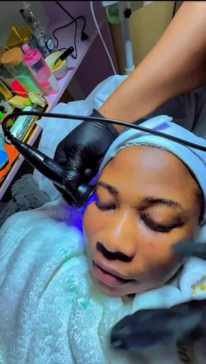 Anti Acne Treatment