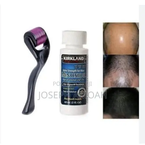 Kirkland Minoxidil