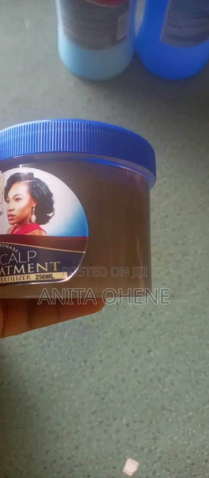 Anti Dandruff Set